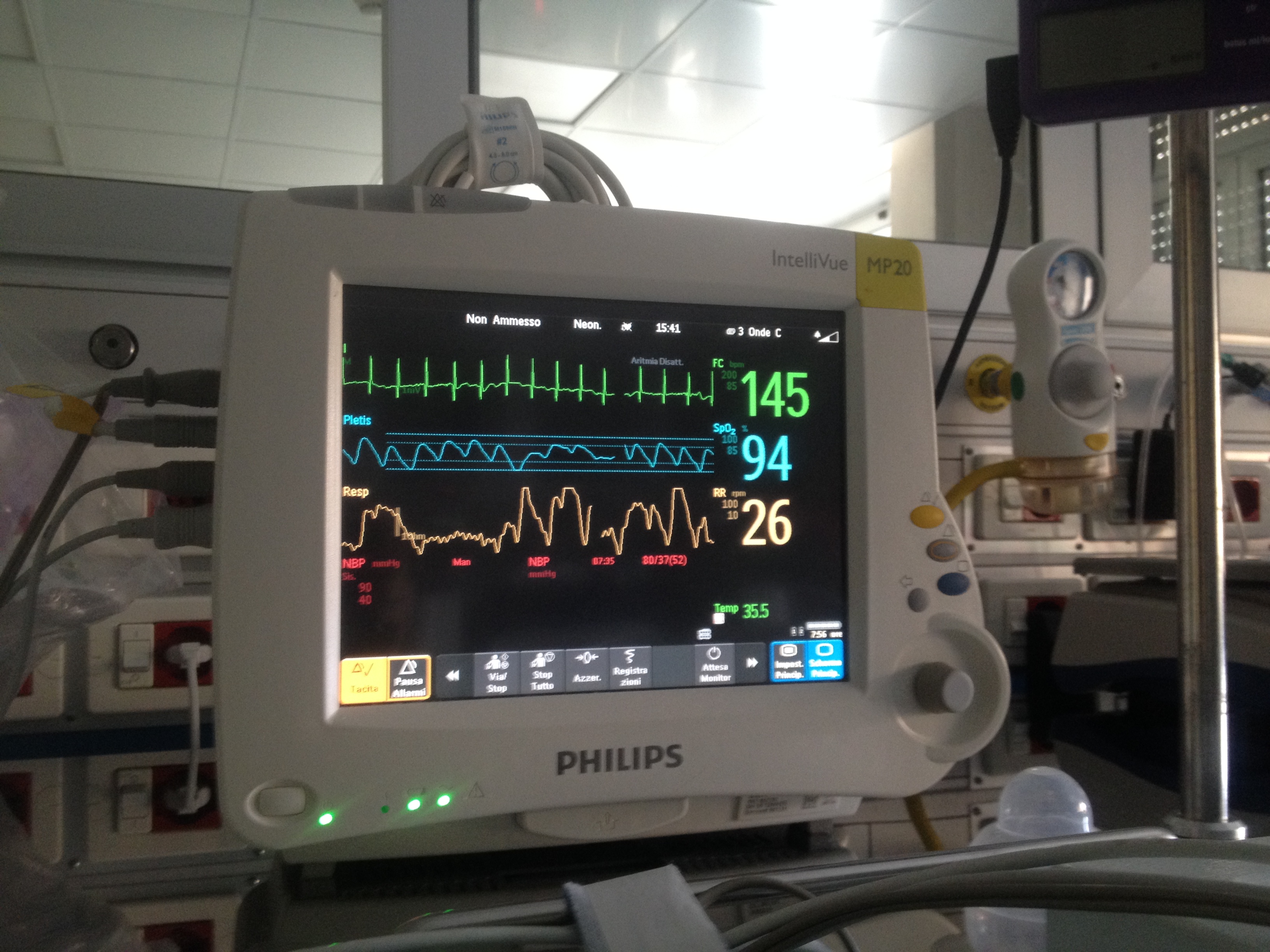 Sei monitor per gli ospedali di Omegna, Verbania e Domodossola