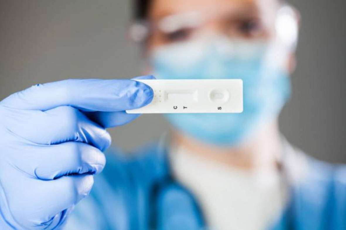 Covid: in Piemonte al via i test rapidi prenotabili nelle farmacie tra cui 140 del Novarese